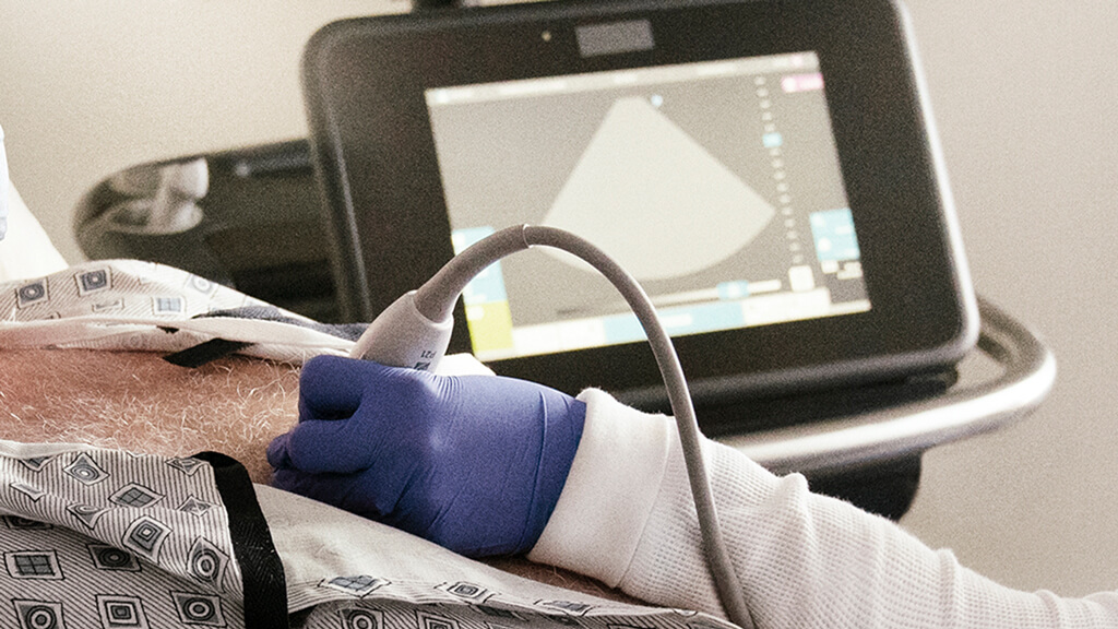 Paciente sometiéndose a un ecocardiograma mientras observa el monitor de ultrasonido.